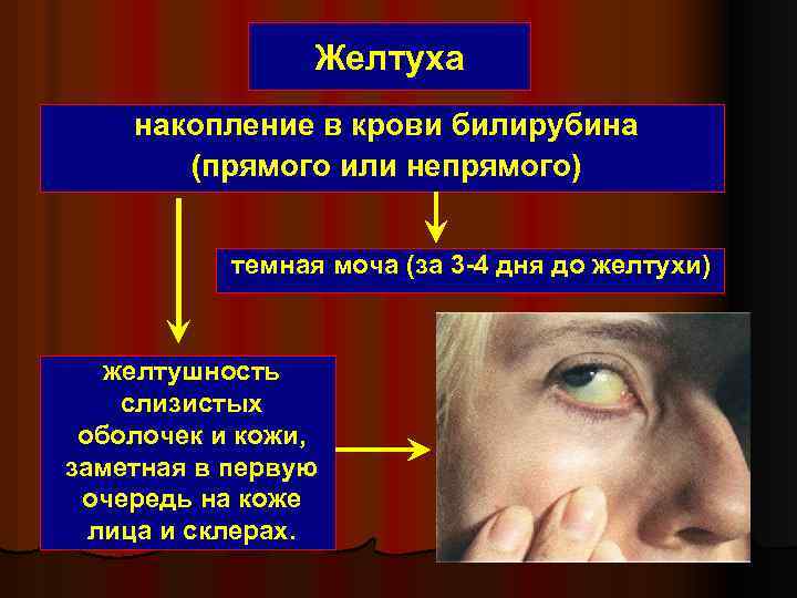 Желтуха накопление в крови билирубина (прямого или непрямого) темная моча (за 3 -4 дня