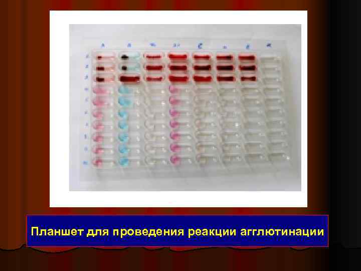 Планшет для проведения реакции агглютинации 