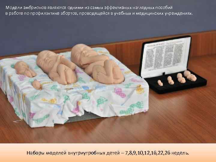 Модели эмбрионов являются одними из самых эффективных наглядных пособий в работе по профилактике абортов,