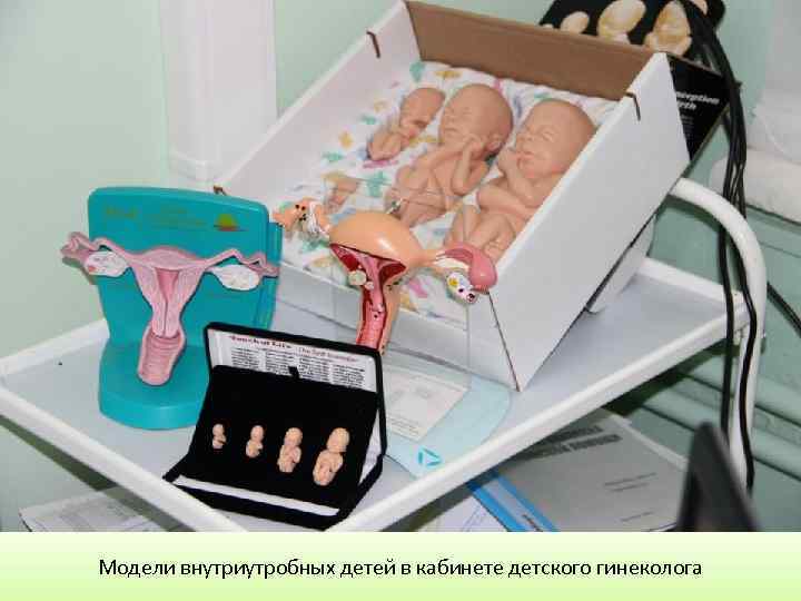Модели внутриутробных детей в кабинете детского гинеколога 