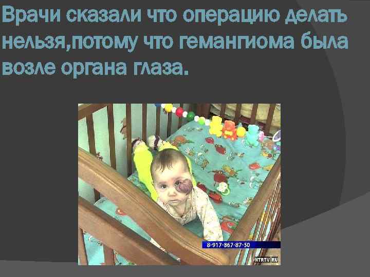 Врачи сказали что операцию делать нельзя, потому что гемангиома была возле органа глаза. 