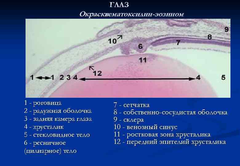 ГЛАЗ Окраска гематоксилин-эозином 1 - роговица 2 - радужная оболочка 3 - задняя камера