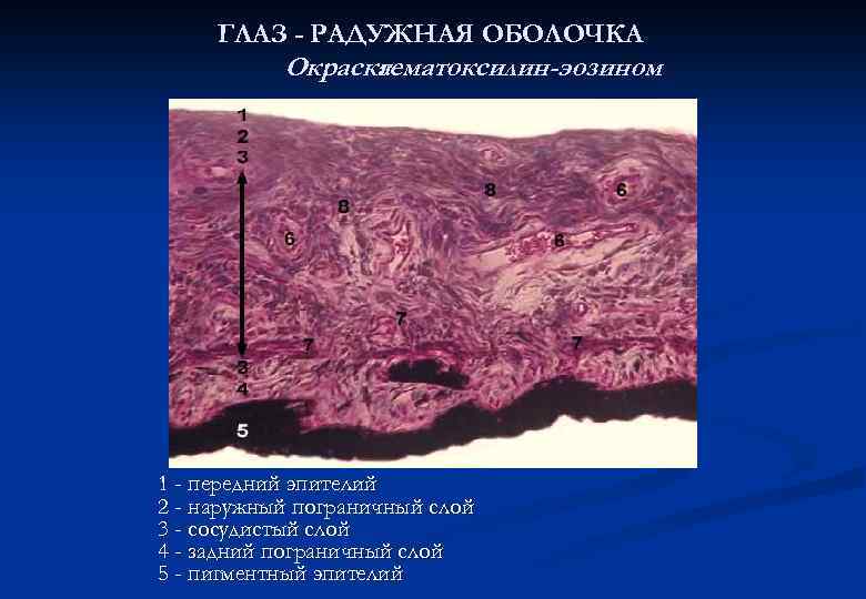 ГЛАЗ - РАДУЖНАЯ ОБОЛОЧКА Окраска гематоксилин-эозином 1 - передний эпителий 2 - наружный пограничный