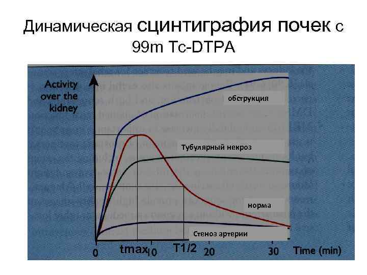 Динамическая сцинтиграфия 99 m Tc-DTPA обструкция Тубулярный некроз норма Стеноз артерии tmax T 1/2