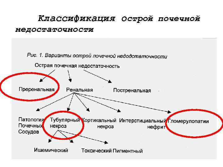 Классификация острой почечной недостаточности 