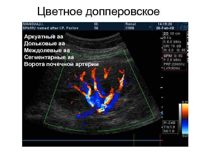 Цветное допперовское картирование Аркуатные аа Дольковые аа Междолевые аа Сегментарные аа Ворота почечной артерии