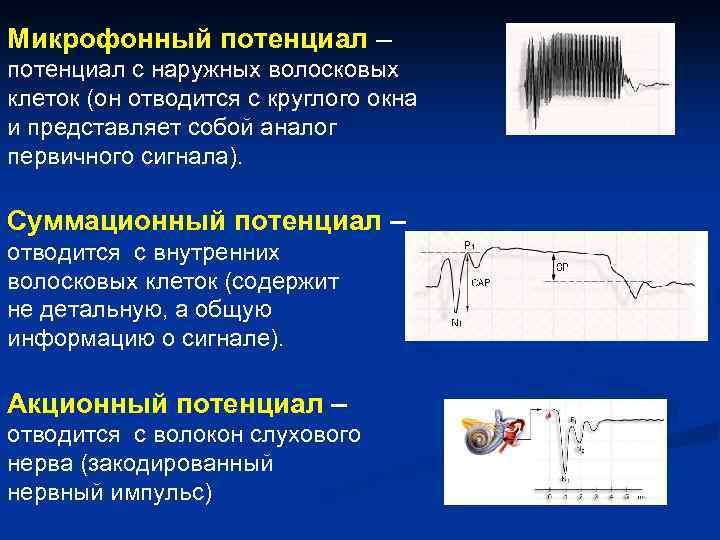 Микрофонный потенциал – потенциал с наружных волосковых клеток (он отводится с круглого окна и