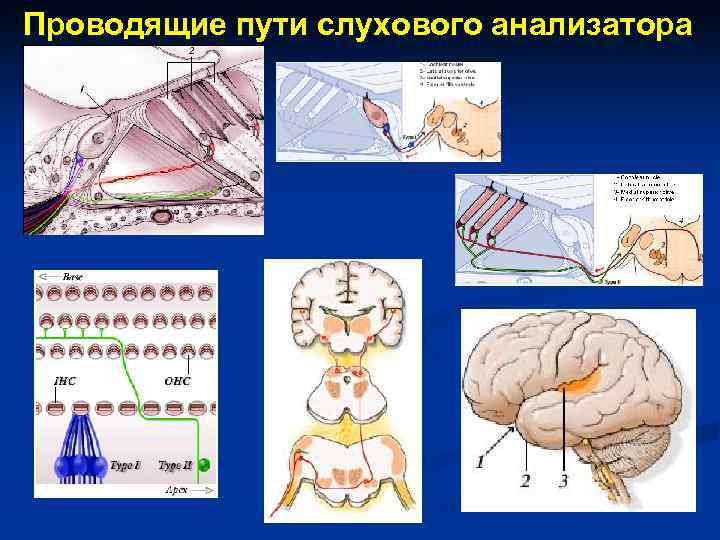 Проводящие пути слухового анализатора 