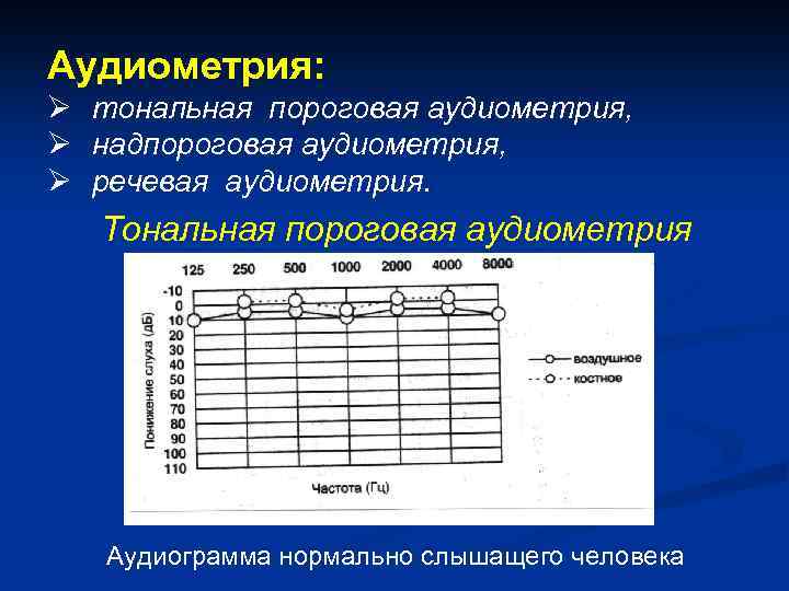 Аудиометрия: Ø тональная пороговая аудиометрия, Ø надпороговая аудиометрия, Ø речевая аудиометрия. Тональная пороговая аудиометрия