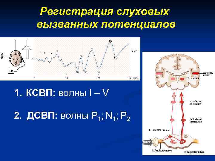 Регистрация слуховых вызванных потенциалов 1. КСВП: волны I – V 2. ДСВП: волны P