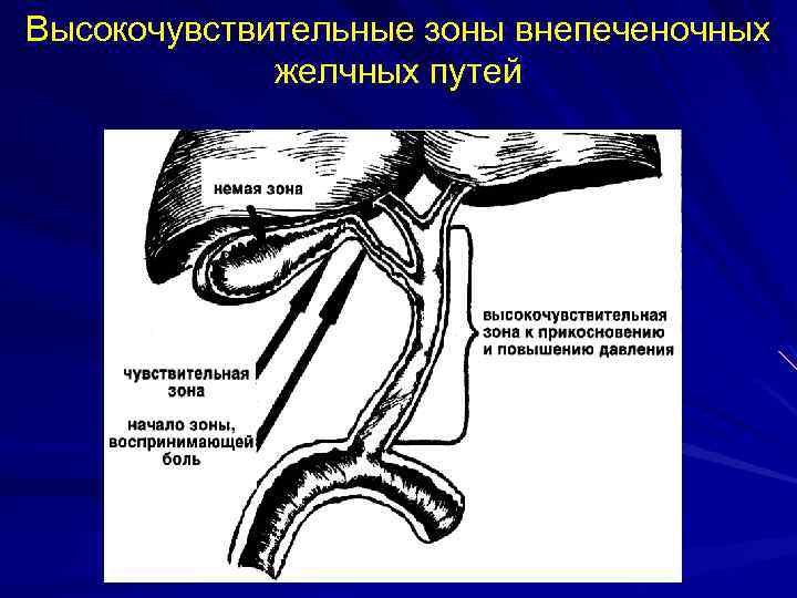 Высокочувствительные зоны внепеченочных желчных путей 