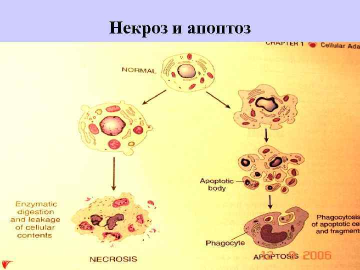 Некроз и апоптоз 