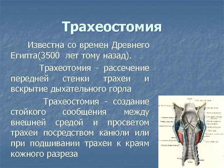 Трахеостомия Известна со времен Древнего Египта(3500 лет тому назад). Трахеотомия - рассечение передней стенки