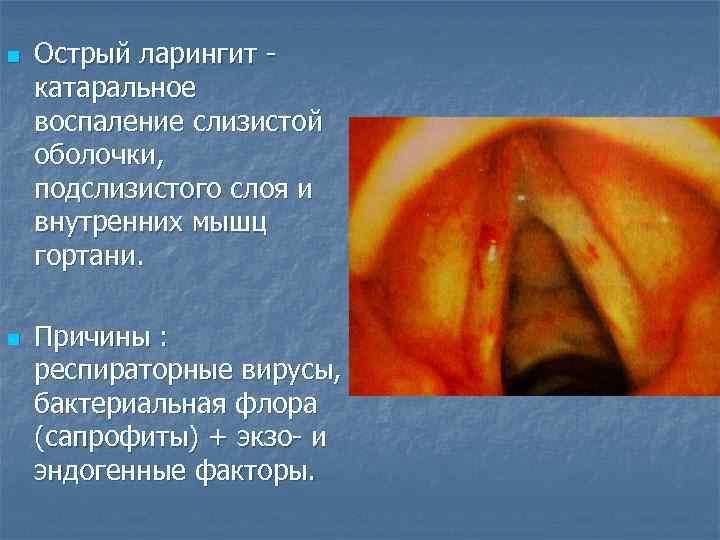 n n Острый ларингит катаральное воспаление слизистой оболочки, подслизистого слоя и внутренних мышц гортани.