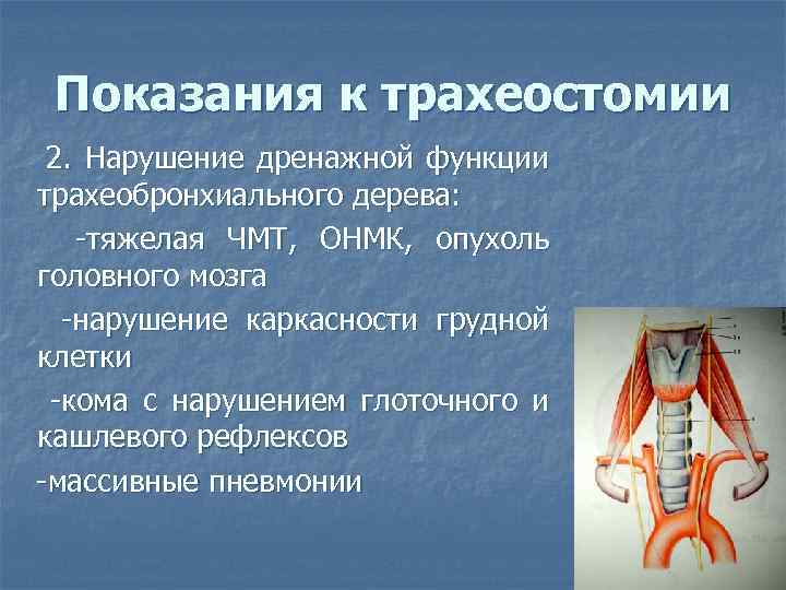 Показания к трахеостомии 2. Нарушение дренажной функции трахеобронхиального дерева: -тяжелая ЧМТ, ОНМК, опухоль головного