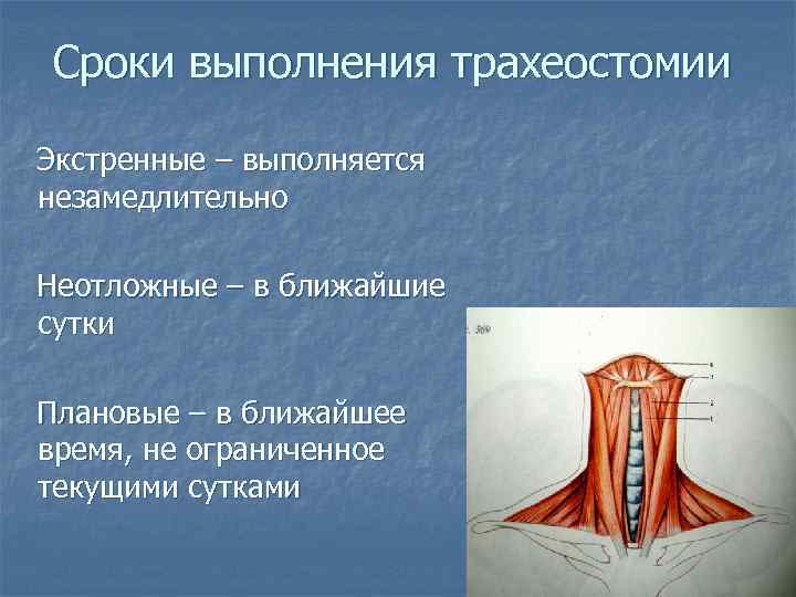 Сроки выполнения трахеостомии Экстренные – выполняется незамедлительно Неотложные – в ближайшие сутки Плановые –