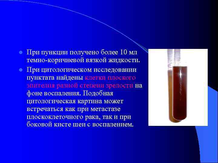 При пункции получено более 10 мл темно-коричневой вязкой жидкости. l При цитологическом исследовании пунктата