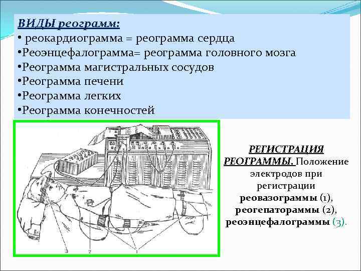 ВИДЫ реограмм: • реокардиограмма = реограмма сердца • Реоэнцефалограмма= реограмма головного мозга • Реограмма