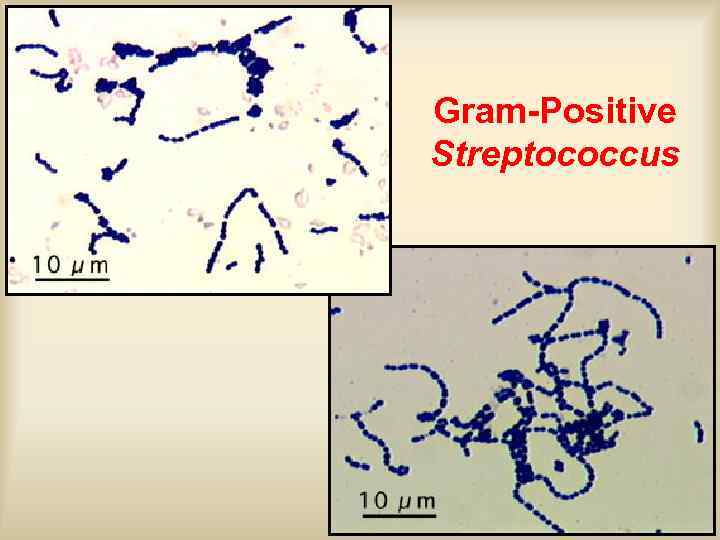 Gram-Positive Streptococcus 