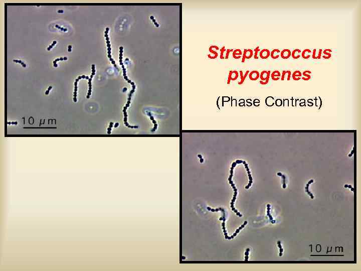 Streptococcus pyogenes (Phase Contrast) 