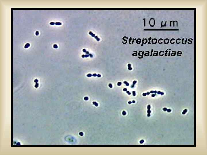 Streptococcus agalactiae 