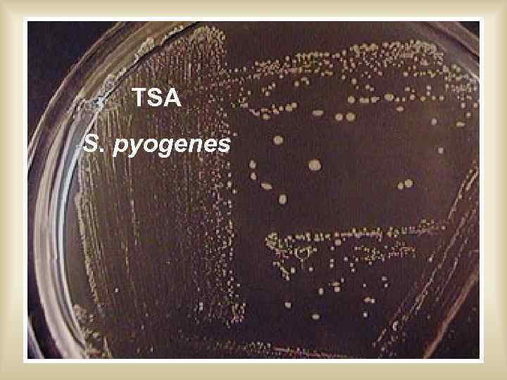 TSA S. pyogenes 