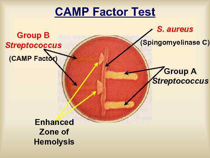 CAMP Factor Test Group B Streptococcus S. aureus (Spingomyelinase C) (CAMP Factor) Group A