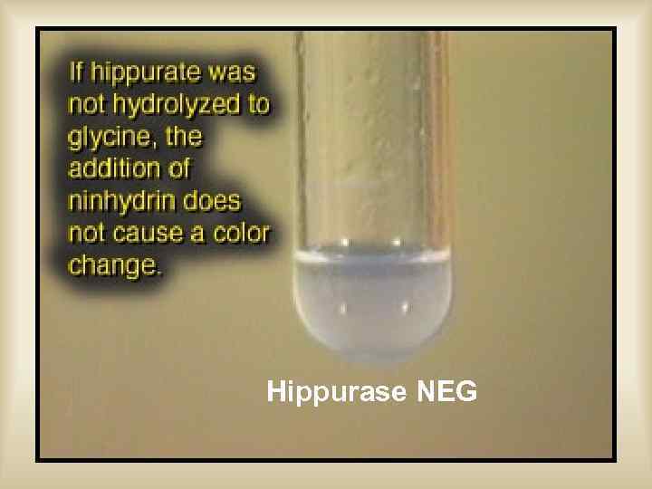 Hippurase NEG 