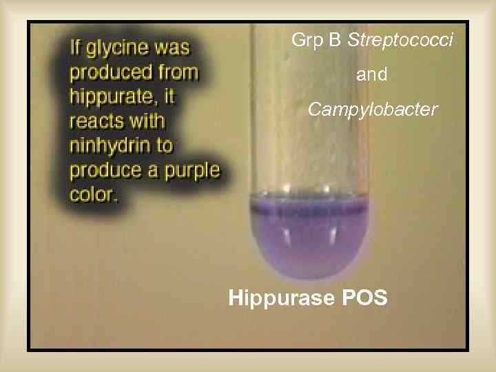 Grp B Streptococci and Campylobacter Hippurase POS 