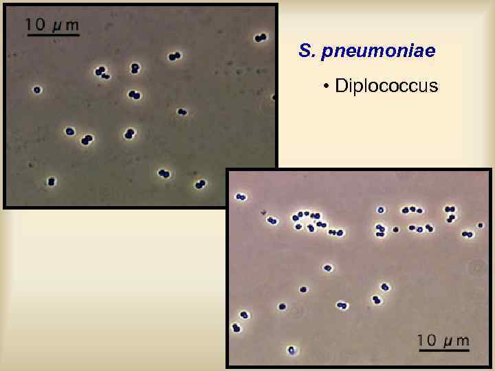 S. pneumoniae • Diplococcus 