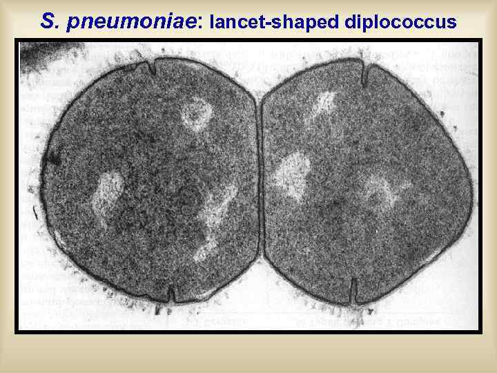 S. pneumoniae: lancet-shaped diplococcus 