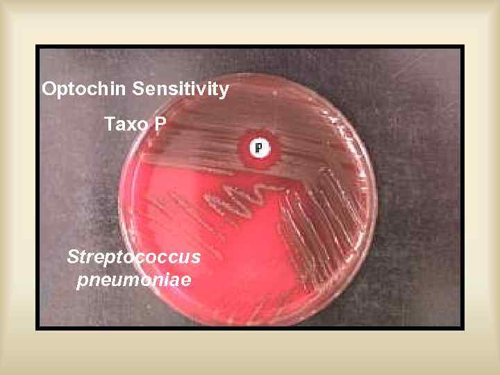 Optochin Sensitivity Taxo P Streptococcus pneumoniae 