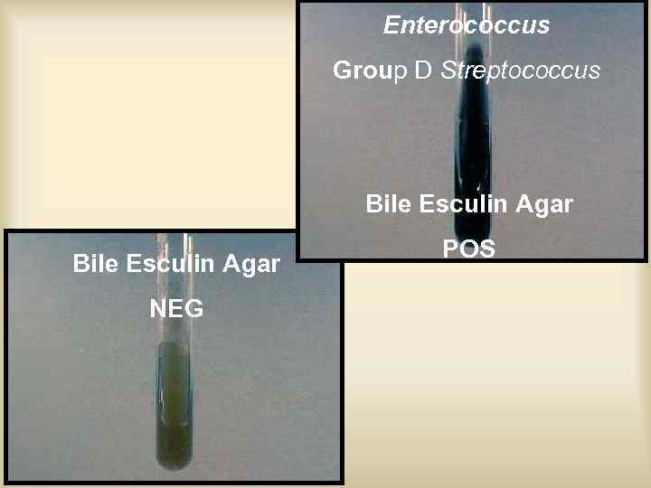 Enterococcus Group D Streptococcus Bile Esculin Agar NEG POS 