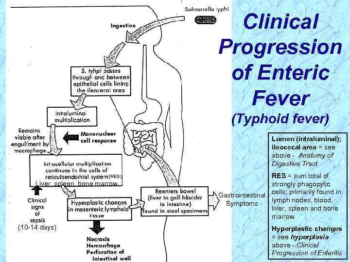 Clinical Progression of Enteric Fever (Typhoid fever) Lumen (intraluminal); ileocecal area = see above
