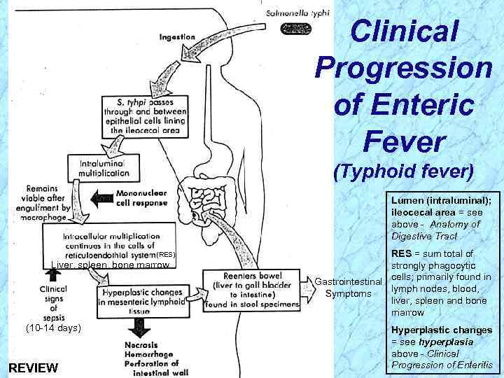 Clinical Progression of Enteric Fever (Typhoid fever) Lumen (intraluminal); ileocecal area = see above