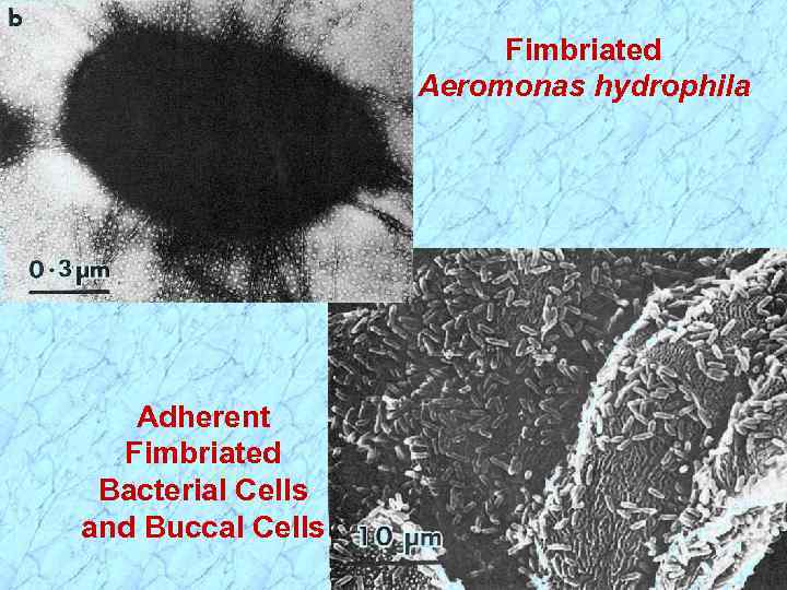 Fimbriated Aeromonas hydrophila Adherent Fimbriated Bacterial Cells and Buccal Cells 