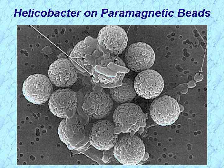 Helicobacter on Paramagnetic Beads 
