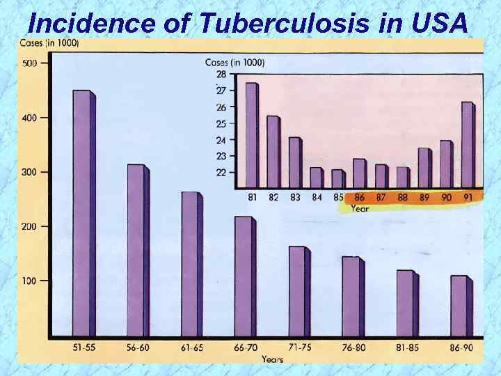 Incidence of Tuberculosis in USA 