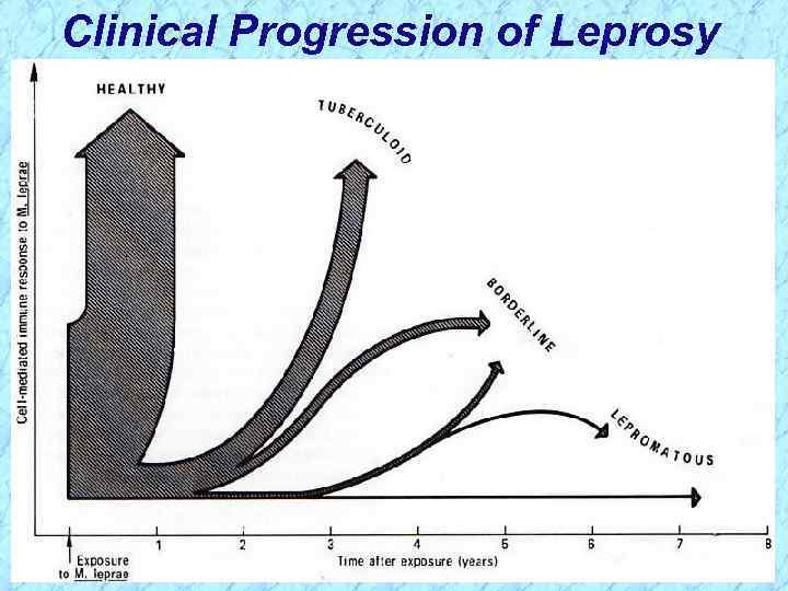 Clinical Progression of Leprosy 