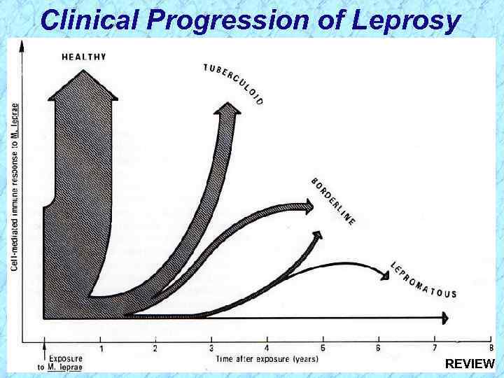 Clinical Progression of Leprosy REVIEW 