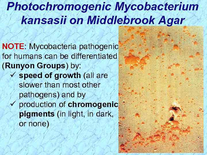 Photochromogenic Mycobacterium kansasii on Middlebrook Agar NOTE: Mycobacteria pathogenic for humans can be differentiated