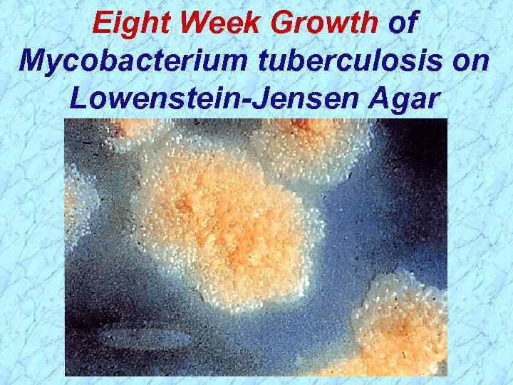 Eight Week Growth of Mycobacterium tuberculosis on Lowenstein-Jensen Agar 