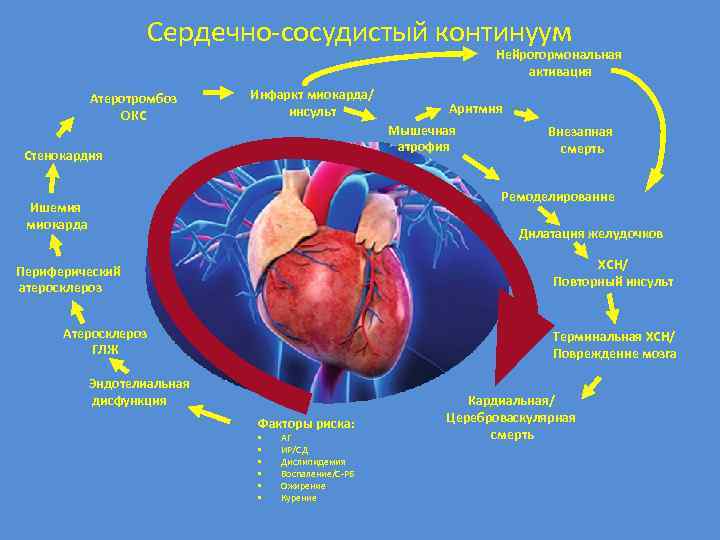 Сердечно-сосудистый континуум Нейрогормональная активация Атеротромбоз ОКС Инфаркт миокарда/ инсульт Аритмия Мышечная атрофия Стенокардия Внезапная