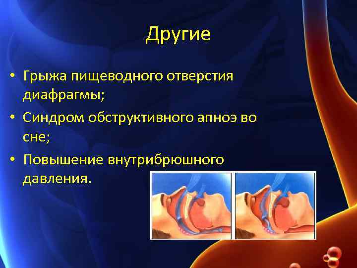 Другие • Грыжа пищеводного отверстия диафрагмы; • Синдром обструктивного апноэ во сне; • Повышение