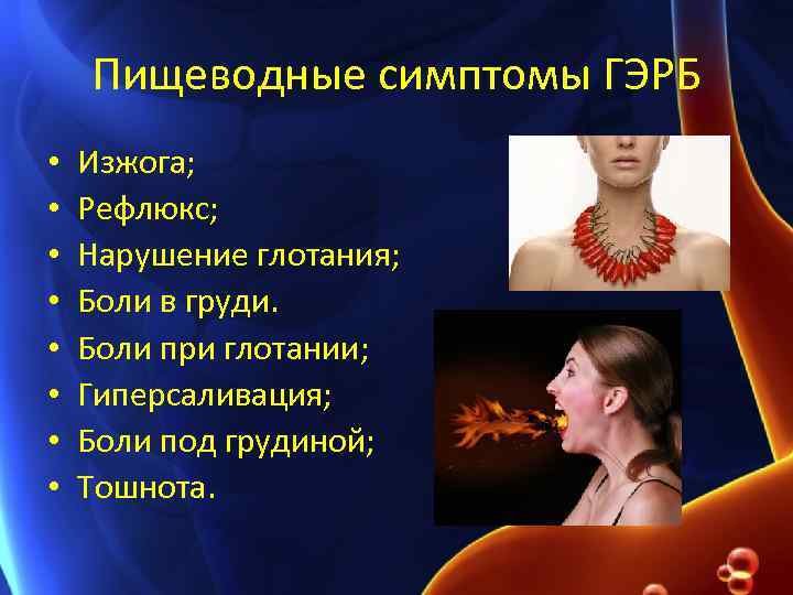 Пищеводные симптомы ГЭРБ • • Изжога; Рефлюкс; Нарушение глотания; Боли в груди. Боли при