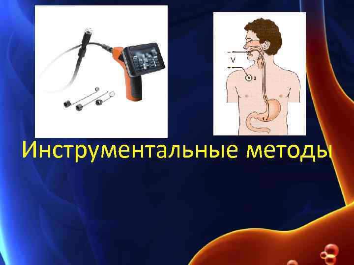 Инструментальные методы 