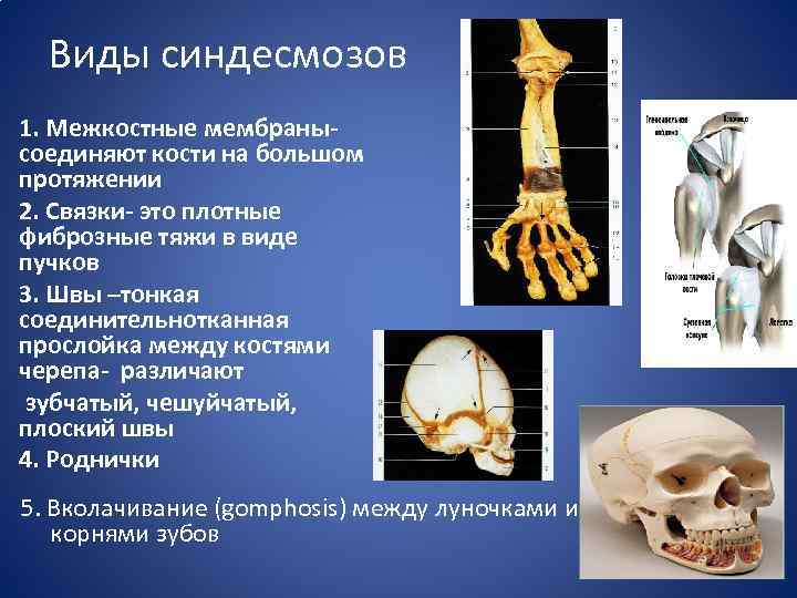 Виды синдесмозов 1. Межкостные мембранысоединяют кости на большом протяжении 2. Связки- это плотные фиброзные