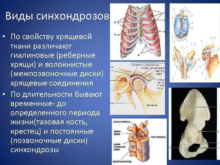 Виды синхондрозов • По свойству хрящевой ткани различают гиалиновые (реберные хрящи) и волокнистые (межпозвоночные