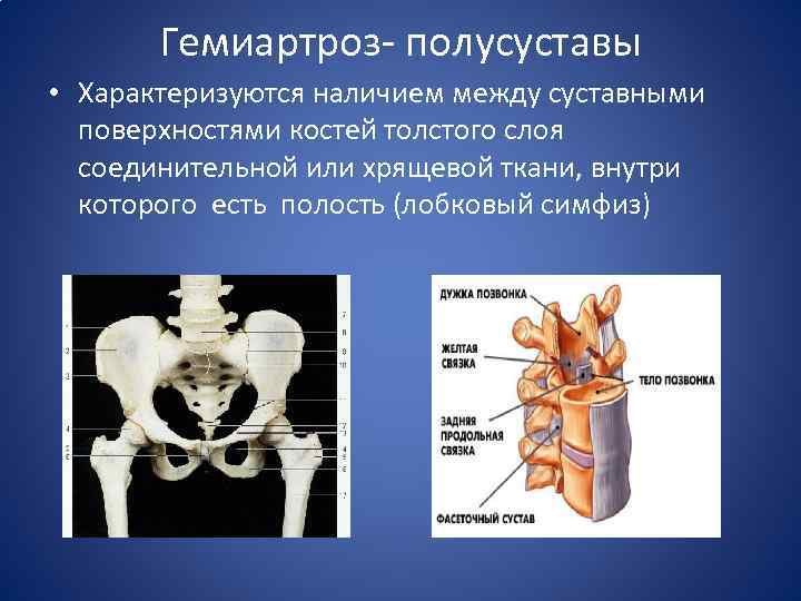 Толстая кость и тонкая