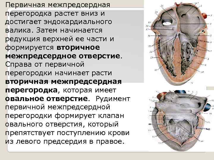 Первичная межпредсердная перегородка растет вниз и достигает эндокардиального валика. Затем начинается редукция верхней ее